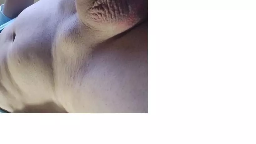 oroadiex