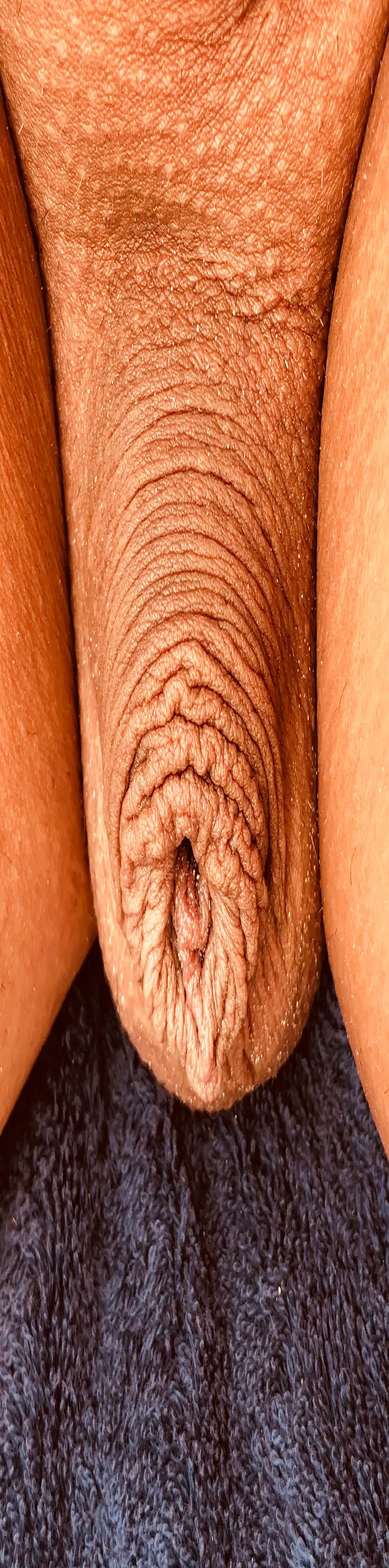 hirslanden1