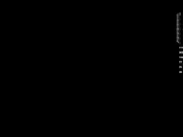 Chaturbate Sex Chat of angelabalay