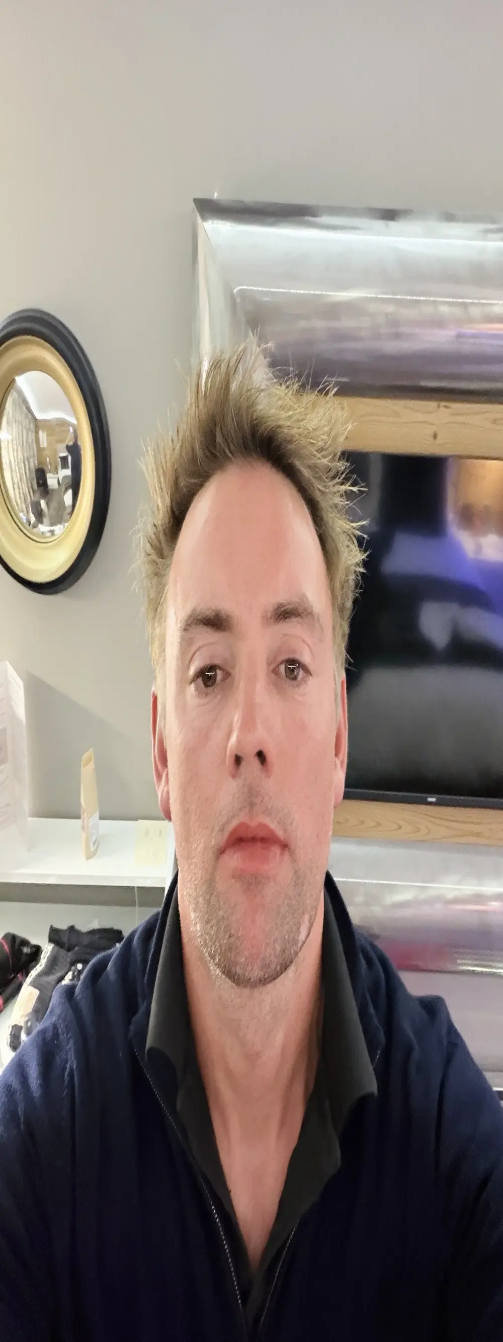 BronzeShowtime67