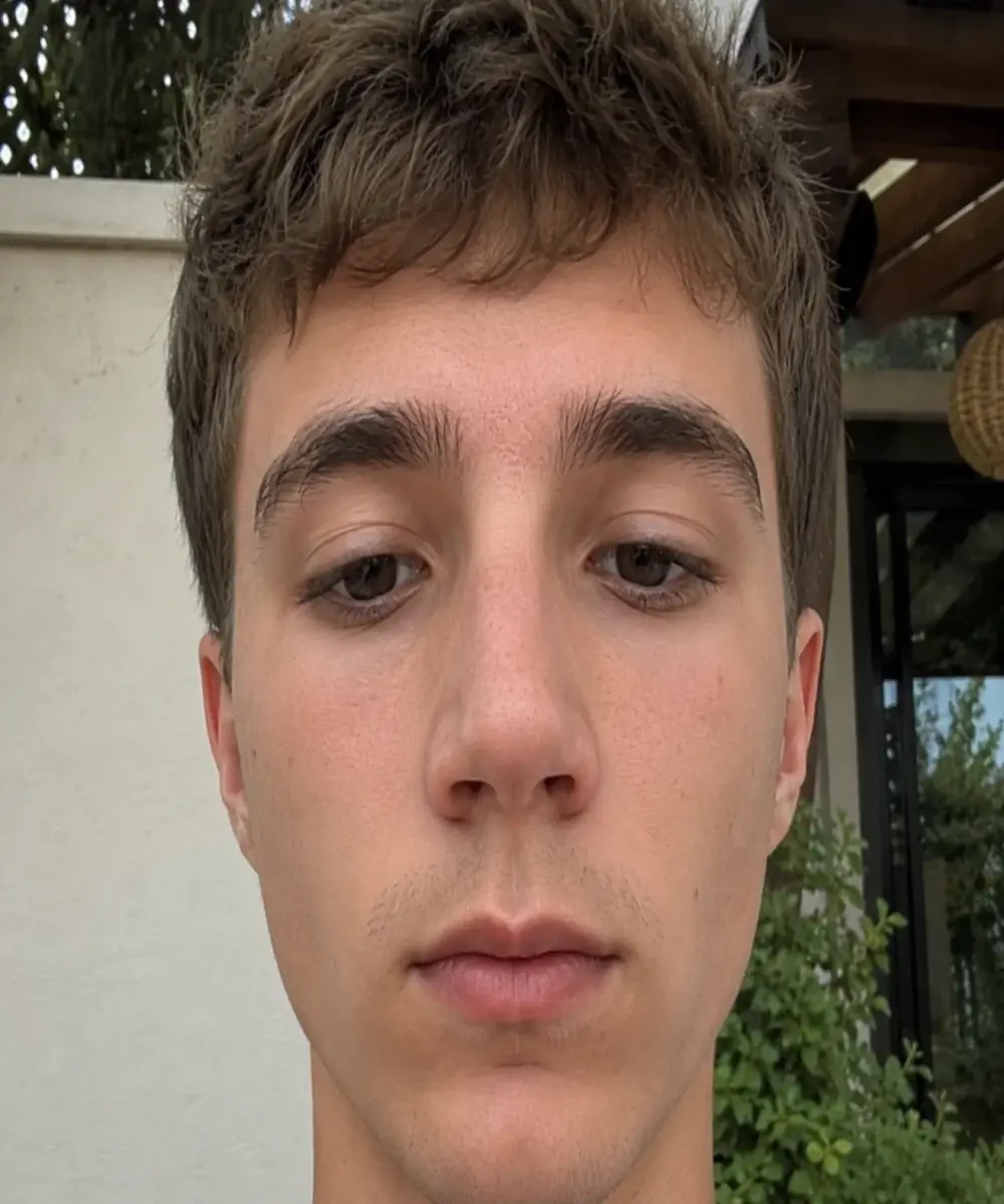 Axel_20