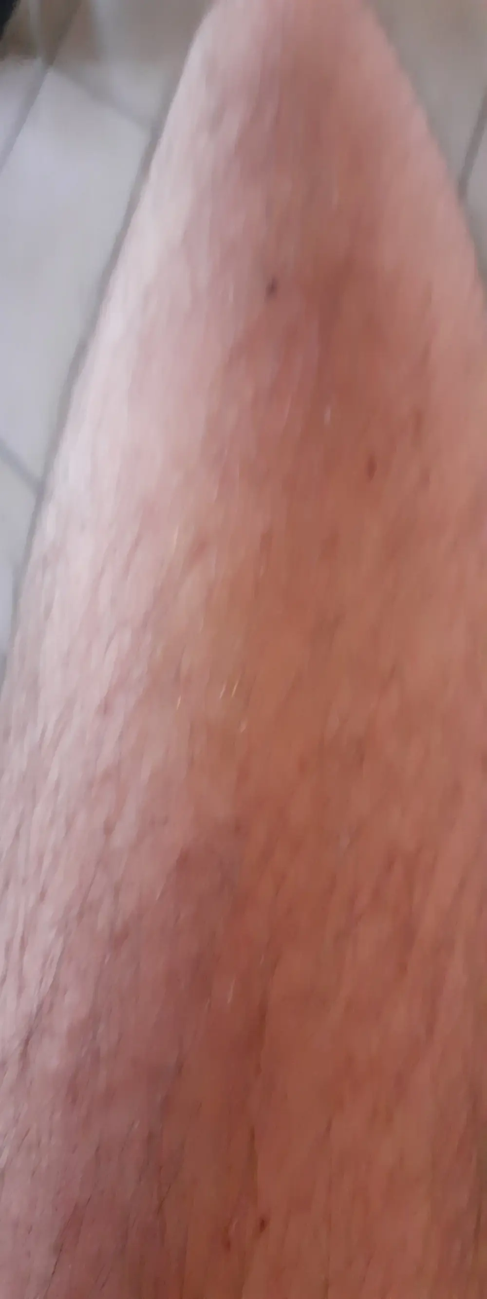 Anderrust