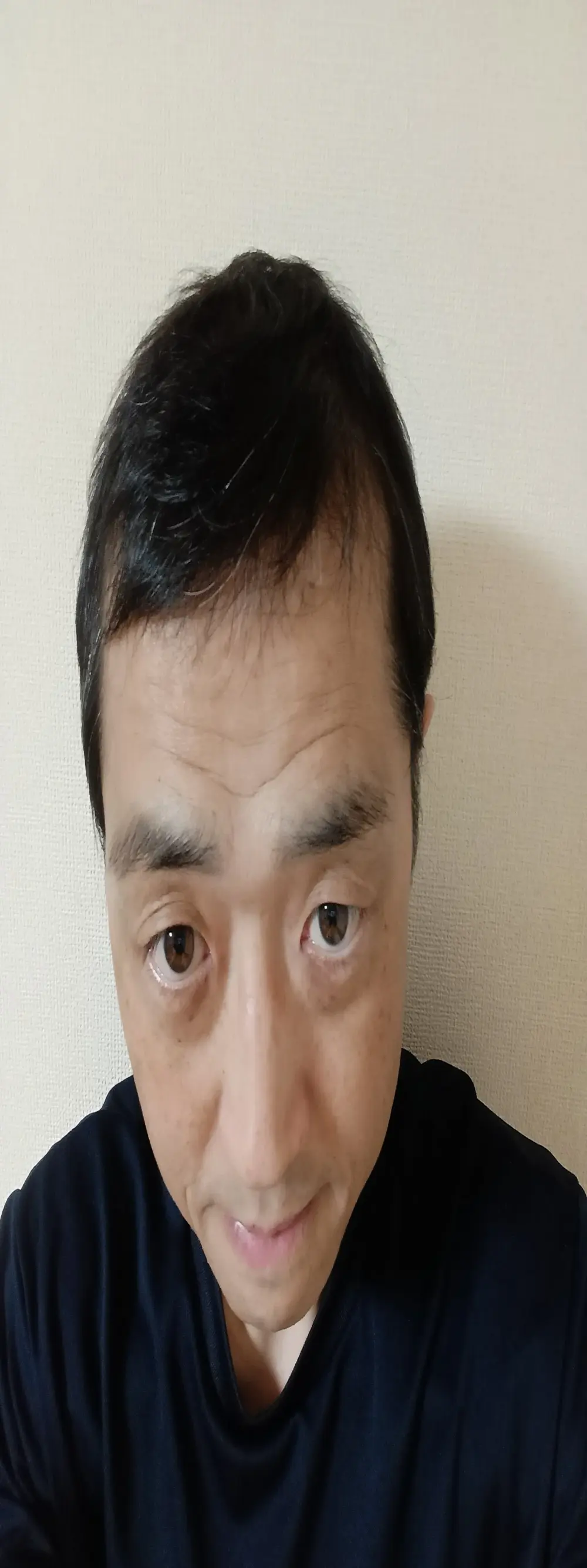 yoci0101